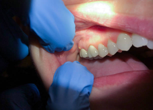 Best Emergency Broken Tooth Repair in Ridge, NY